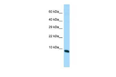 Western Blot: MIR22 host gene Antibody [NBP3-09598] - Western blot analysis of MIR22 host gene in Fetal Brain lysates. Antibody dilution at 1.0ug/ml