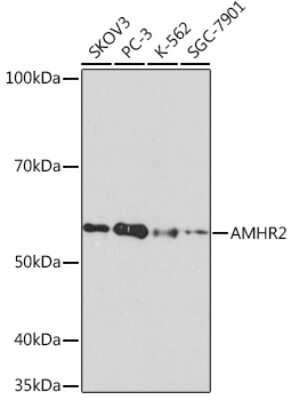 Western Blot: MIS RII/AMHR2 Antibody (8Z8X4) [NBP3-16706] - Western blot analysis of extracts of various cell lines, using MIS RII/AMHR2 Rabbit mAb (NBP3-16706) at 1:1000 dilution. Secondary antibody: HRP Goat Anti-Rabbit IgG (H+L) at 1:10000 dilution. Lysates/proteins: 25ug per lane. Blocking buffer: 3% nonfat dry milk in TBST. Detection: ECL Basic Kit. Exposure time: 3min.