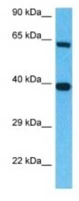 Western Blot: MIS RII/AMHR2 Antibody [NBP3-09957] - Western blot analysis of MIS RII/AMHR2 in 721_B Whole Cell lysates. Antibody dilution at 1.0ug/ml