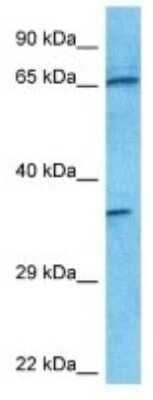 Western Blot: MIS RII/AMHR2 Antibody [NBP3-09975] - Western blot analysis of MIS RII/AMHR2 in 786-0 Whole Cell lysates. Antibody dilution at 1.0ug/ml