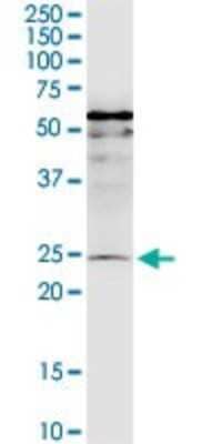 Western Blot: MIS12 Antibody (1G3) [H00079003-M01] - MIS12 monoclonal antibody (M01), clone 1G3. Analysis of MIS12 expression in IMR-32.