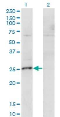 Western Blot: MIS12 Antibody (1G3) [H00079003-M01] - Analysis of MIS12 expression in transfected 293T cell line by MIS12 monoclonal antibody (M01), clone 1G3.Lane 1: MIS12 transfected lysate(24.1 KDa).Lane 2: Non-transfected lysate.