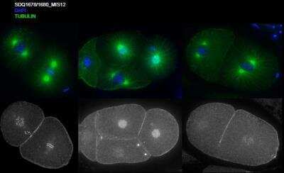 Immunocytochemistry/Immunofluorescence: MIS12 Antibody [35550002] - This animal is specific to animal number SDQ1678Q1680 Methanol fixation; 1 hr