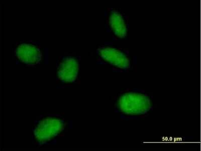 Immunocytochemistry/Immunofluorescence: MIS12 Antibody [H00079003-B02P] - Analysis of purified antibody to MIS12 on HeLa cell. (antibody concentration 10 ug/ml)