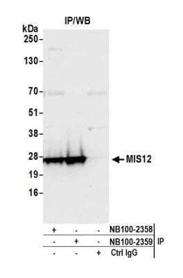 Immunoprecipitation: MIS12 Antibody [NB100-2358] - Detection of human MIS12 by western blot of immunoprecipitates. Samples: Whole cell lysate (1.0 mg per IP reaction; 20% of IP loaded) from HeLa cells prepared using NETN lysis buffer. Antibodies: Affinity purified rabbit anti-MIS12 antibody NB100-2358 used for IP at 3 ug per reaction. MIS12 was also immunoprecipitated by rabbit anti-MIS12 antibody NB100-2359. For blotting immunoprecipitated MIS12, NB100-2359 was used at 1 ug/ml. Detection: Chemiluminescence with an exposure time of 30 seconds.