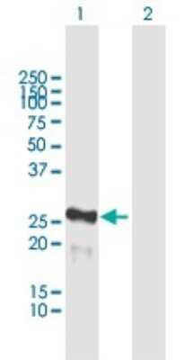 Western Blot: MIS12 Antibody [H00079003-B02P] - Analysis of MIS12 expression in transfected 293T cell line by MIS12 polyclonal antibody.  Lane 1: MIS12 transfected lysate(22.55 KDa). Lane 2: Non-transfected lysate.