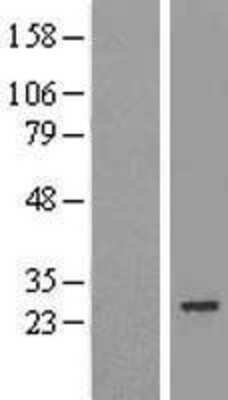 Western Blot: MIS12 Overexpression Lysate (Adult Normal) [NBL1-13115] Left-Empty vector transfected control cell lysate (HEK293 cell lysate); Right -Over-expression Lysate for MIS12.