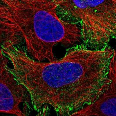 Immunocytochemistry/Immunofluorescence: MISP1 Antibody [NBP2-14390] - Staining of human cell line U-2 OS shows localization to plasma membrane and focal adhesion sites.