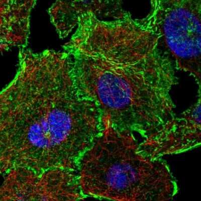 Immunocytochemistry/Immunofluorescence: MISP1 Antibody [NBP2-38955] - Immunofluorescent staining of human cell line A549 shows localization to plasma membrane & focal adhesion sites.
