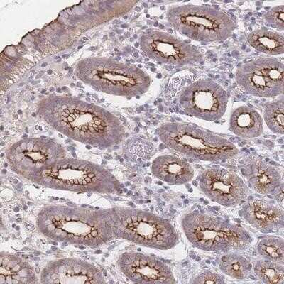 Immunohistochemistry-Paraffin: MISP1 Antibody [NBP2-14390] - Staining of human stomach, lower shows strong membranous and cytoplasmic positivity in glandular cells.