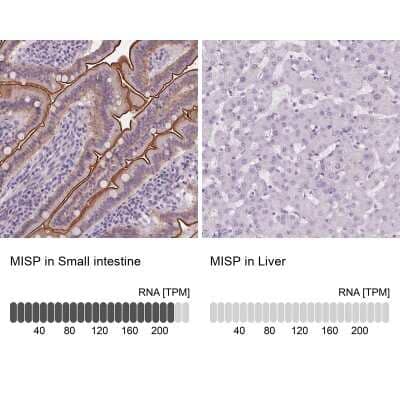 <b>Orthogonal Strategies Validation. </b>Immunohistochemistry-Paraffin: MISP1 Antibody [NBP2-14390] - Staining in human small intestine and liver tissues using anti-MISP antibody. Corresponding MISP RNA-seq data are presented for the same tissues.