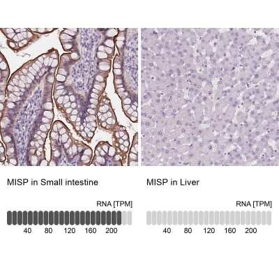 <b>Orthogonal Strategies Validation. </b>Immunohistochemistry-Paraffin: MISP1 Antibody [NBP2-14390] - Analysis in human small intestine and liver tissues. Corresponding MISP1 RNA-seq data are presented for the same tissues.