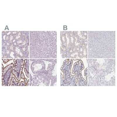 <b>Independent Antibodies Validation. </b>Immunohistochemistry-Paraffin: MISP1 Antibody [NBP2-14390] - Staining of human kidney, liver, small intestine and testis using Anti-MISP1 antibody NBP2-14390 (A) shows similar protein distribution across tissues to independent antibody NBP2-38955 (B).