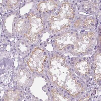 Immunohistochemistry-Paraffin: MISP1 Antibody [NBP2-14390] - Staining of human kidney shows moderate positivity in luminal membrane in cells in tubules.