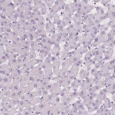 Immunohistochemistry-Paraffin: MISP1 Antibody [NBP2-14390] - Staining of human liver shows no positivity in hepatocytes as expected.