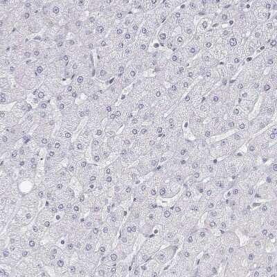 Immunohistochemistry-Paraffin: MISP1 Antibody [NBP2-38955] - Staining of human liver shows no positivity in hepatocytes as expected.
