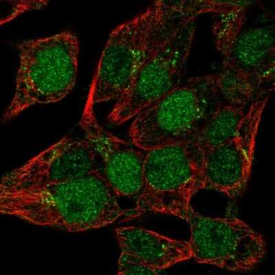 Immunocytochemistry/Immunofluorescence: MIST1 Antibody [NBP2-30979] - Staining of human cell line Hep G2 shows localization to nucleoplasm & the Golgi apparatus.