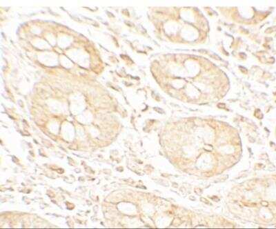 Immunohistochemistry: MIST1 Antibody [NBP2-82007] - Analysis of MIST1 in human small intestine tissue with MIST1 antibody at 5 ug/ml.