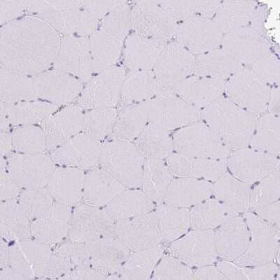 Immunohistochemistry-Paraffin: MIST1 Antibody [NBP2-30979] - Staining of human skeletal muscle shows no positivity in striated muscle fibers as expected.