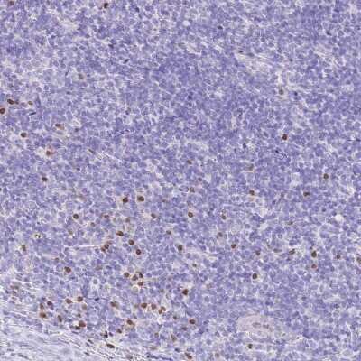 Immunohistochemistry-Paraffin: MIST1 Antibody [NBP2-30979] - Staining of human tonsil shows moderate to strong nuclear positivity in non-germinal center cells.