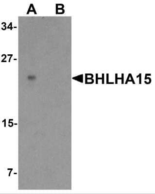 Western Blot: MIST1 Antibody [NBP2-82007] - Analysis of MIST1 in rat small intestine tissue lysate with MIST1 Antibody at 1 ug/ml in (A) the absence and (B) the presence of blocking peptide.