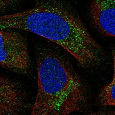 Immunocytochemistry/ Immunofluorescence MITD1 Antibody