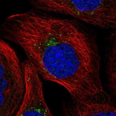 Immunocytochemistry/Immunofluorescence: MITD1 Antibody [NBP2-32721] - Immunofluorescent staining of human cell line A-431 shows localization to vesicles.