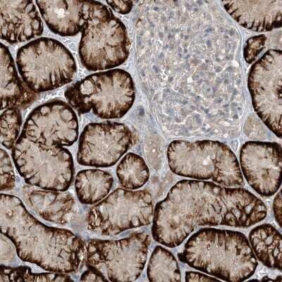 Immunohistochemistry-Paraffin: MITD1 Antibody [NBP2-32721] - Staining of human kidney shows strong cytoplasmic positivity in cells in tubules.