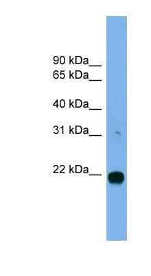 Western Blot: MITD1 Antibody [NBP1-57006] - MCF-7 whole cell lysates, concentration 0.2-1 ug/ml.