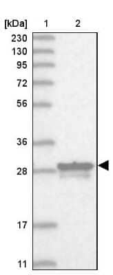 Western Blot MITD1 Antibody