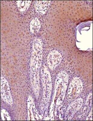 Immunohistochemistry-Paraffin: MITF Antibody (21D1418) - Azide Free [NBP2-33229] - MITF Antibody (21D1418) [NB100-56561] - Analysis of a FFPE tissue section of human skin using 1:200 dilution of MITF (21D1418)  antibody. The staining was developed using HRP labeled anti-rabbit secondary antibody and DAB reagent, and nuclei of cells were counter-stained with hematoxylin. General cytoplasmic staining appears enriched in melanocytes below the epidermis. Some nuclear reactivity is observed as well.