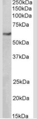 Western Blot: MITF Antibody (21D1418) - Azide Free [NBP2-33229] - Analysis of HeLa lysate (35ug per lane, RIPA buffer) using MiTF antibody (NB100-56561) at 0.1ug/ml. Band detected at ~60kDa. (Expected MW of 58.2kDa according to NP_937802.1).