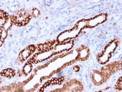 Immunohistochemistry-Paraffin: MITF Antibody (C5/D5) - IHC-Prediluted [NBP2-48263] - Formalin-fixed, paraffin-embedded human Kidney stained with KSP-Cadherin Mouse Monoclonal Antibody (CDH16/1071).