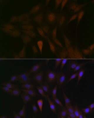 Immunocytochemistry/Immunofluorescence: MKK3/MEK3 Antibody (8U2X3) [NBP3-16163] - Immunofluorescence analysis of C6 cells using MKK3/MEK3 Rabbit mAb (NBP3-16163) at dilution of 1:100 (40x lens). Blue: DAPI for nuclear staining.