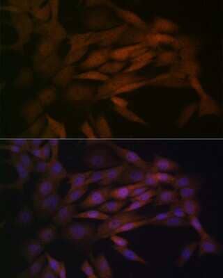 Immunocytochemistry/Immunofluorescence: MKK3/MEK3 Antibody (8U2X3) [NBP3-16163] - Immunofluorescence analysis of NIH-3T3 cells using MKK3/MEK3 Rabbit mAb (NBP3-16163) at dilution of 1:100 (40x lens). Blue: DAPI for nuclear staining.