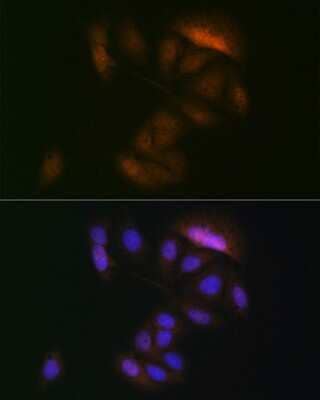 Immunocytochemistry/Immunofluorescence: MKK3/MEK3 Antibody (8U2X3) [NBP3-16163] - Immunofluorescence analysis of U-2 OS cells using MKK3/MEK3 Rabbit mAb (NBP3-16163) at dilution of 1:100 (40x lens). Blue: DAPI for nuclear staining.