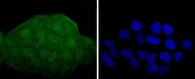Immunocytochemistry/Immunofluorescence: MKK3/MEK3 Antibody (JJ087-09) [NBP2-67873] - Staining MEK3+MEK6 in Hela cells (green). The nuclear counter stain is DAPI (blue). Cells were fixed in paraformaldehyde, permeabilised with 0.25% Triton X100/PBS.