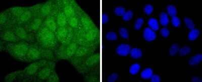 Immunocytochemistry/Immunofluorescence: MKK3/MEK3 Antibody (JJ087-09) [NBP2-67873] - Staining MEK3+MEK6 in HepG2 cells (green). The nuclear counter stain is DAPI (blue). Cells were fixed in paraformaldehyde, permeabilised with 0.25% Triton X100/PBS.