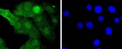 Immunocytochemistry/Immunofluorescence: MKK3/MEK3 Antibody (JJ087-09) [NBP2-67873] - Staining MEK3+MEK6 in NIH/3T3 cells (green). The nuclear counter stain is DAPI (blue). Cells were fixed in paraformaldehyde, permeabilised with 0.25% Triton X100/PBS.