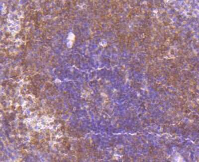 Immunohistochemistry-Paraffin: MKK3/MEK3 Antibody (JJ087-09) [NBP2-67873] - Analysis of paraffin-embedded human spleen tissue using anti-MEK3+MEK6 antibody. Counter stained with hematoxylin.