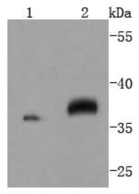 Western Blot: MKK3/MEK3 Antibody (JJ087-09) [NBP2-67873] - Analysis of MEK3+MEK6 on different lysates using anti-MEK3+MEK6 antibody at 1/1,000 dilution. Positive control: Lane 1: Hela Lane 2: Jurkat