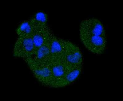 Immunohistochemistry-Paraffin: MKK3/MEK3 Antibody (SD20-93) [NBP2-67747] - Analysis of paraffin-embedded human liver tissue using anti-MEK3 antibody. Counter stained with hematoxylin.
