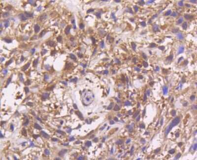 Immunohistochemistry-Paraffin: MKK3/MEK3 Antibody (SD20-93) [NBP2-67747] - Analysis of paraffin-embedded mouse spleen tissue using anti-MEK3 antibody. Counter stained with hematoxylin.