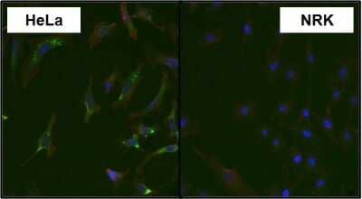 Immunocytochemistry/Immunofluorescence: MKK4/MEK4 Antibody (2 E4) [NBP2-22482] - Analysis of MAP2K4 using anti-MAP2K4 monoclonal antibody shows specific expression in HeLa cells (shown in green) but not in negative control NRK cells. Formalin fixed cells were permeabilized with 0.1% Triton X-100 in TBS for 10 minutes at room temperature. Cells were blocked with 1% Blocker BSA for 15 minutes at room temperature. Cells were probed with a mouse monoclonal antibody recognizing MAP2K4, at a dilution of 1:50 for at least 1 hour at room temperature. Cells were washed with PBS and incubated with DyLight 488 goat-anti-mouse IgG secondary antibody at a dilution of 1:400 for 30 minutes at room temperature. F-Actin (red) was stained with DY-554 phalloidin, nuclei (blue) were stained with Hoechst 33342 dye.