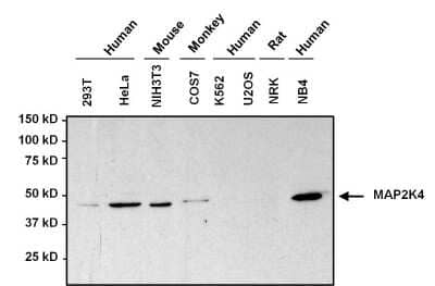 Western Blot: MKK4/MEK4 Antibody (2 E4) [NBP2-22482] - Analysis of 50ug whole cell lysate.