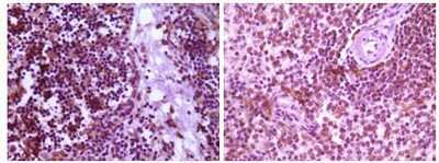 Immunohistochemistry-Paraffin: MKK4/MEK4 Antibody (2D10D8) [NBP1-28877] - Immunohistochemical analysis of paraffin-embedded human thymoma tissue (left) and spleen tissue (right), showing cytoplasmic localization using MAP2K4 mouse mAb with DAB staining.