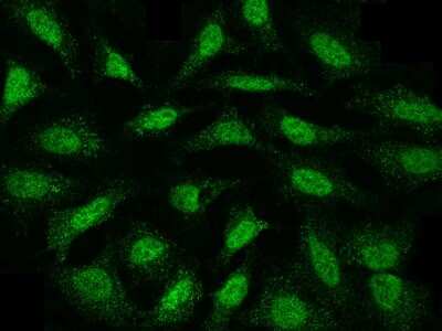 Immunocytochemistry/Immunofluorescence: MKK4/MEK4 Antibody [NBP2-99331] - Immunofluorescence staining of MKK4/MEK4 in HeLa cells. Cells were fixed with 4% PFA, permeabilzed with 0.3% Triton X-100 in PBS, blocked with 10% serum, and incubated with rabbit anti-HUMAN MKK4/MEK4 polyclonal antibody (dilution ratio 1:1000) at 4C overnight. Then cells were stained with the Alexa Fluor$488-conjugated Goat Anti-rabbit IgG Secondary antibody (green). Positive staining was localized to cytoplasm and nucleus.