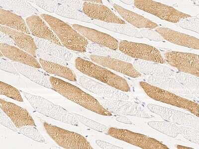 Immunohistochemistry-Paraffin: MKK4/MEK4 Antibody [NBP2-99331] - Immunochemical staining of human MKK4/MEK4 in human skeletal muscle with rabbit polyclonal antibody at 1:1000 dilution, formalin-fixed paraffin embedded sections.