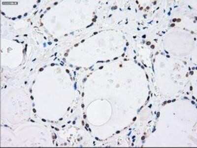 Immunohistochemistry: MKK4/MEK4 Antibody (OTI8A8) - Azide and BSA Free [NBP2-72710] - Staining of paraffin-embedded Human thyroid tissue using anti-MEK4 mouse monoclonal antibody.