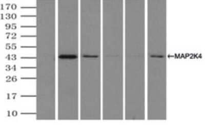 Immunoprecipitation: MKK4/MEK4 Antibody (OTI8A8) - Azide and BSA Free [NBP2-72710] - (Negative control: IP without adding anti-MAP2K4 antibody.). For each experiment, 500ul of DDK tagged MAP2K4 overexpression lysates (at 1:5 dilution with HEK293T lysate), 2ug of anti-MAP2K4 antibody and 20ul (0.1mg) of goat anti-mouse conjugated magnetic beads were mixed and incubated overnight. After extensive wash to remove any non-specific binding, the immuno-precipitated products were analyzed with rabbit anti-DDK polyclonal antibody.